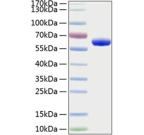 SDS-PAGE - Recombinant Human EPOR Protein (C-terminal Human Fc and His Tag) (A330587) - Antibodies.com