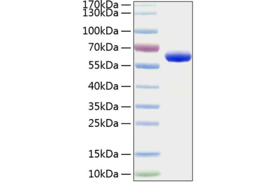 SDS-PAGE - Recombinant Human EPOR Protein (C-terminal Human Fc and His Tag) (A330587) - Antibodies.com
