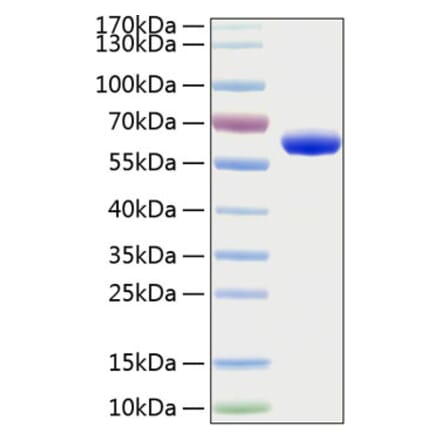 SDS-PAGE - Recombinant Human EPOR Protein (C-terminal Human Fc and His Tag) (A330587) - Antibodies.com