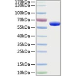 SDS-PAGE - Recombinant Human EPOR Protein (C-terminal Human Fc and His Tag) (A330587) - Antibodies.com
