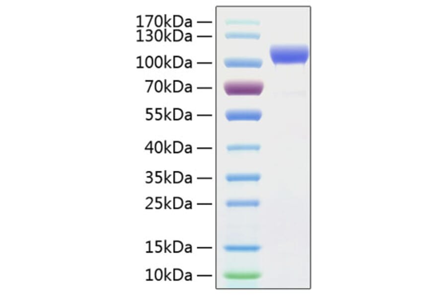 SDS-PAGE - Recombinant Human ErbB2 Protein (C-terminal His Tag) (A330588) - Antibodies.com