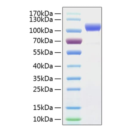 SDS-PAGE - Recombinant Human ErbB2 Protein (C-terminal His Tag) (A330588) - Antibodies.com