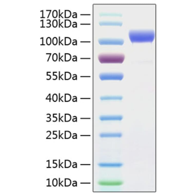 SDS-PAGE - Recombinant Human ErbB2 Protein (C-terminal His Tag) (A330588) - Antibodies.com