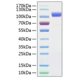 SDS-PAGE - Recombinant Human ErbB2 Protein (C-terminal His Tag) (A330588) - Antibodies.com
