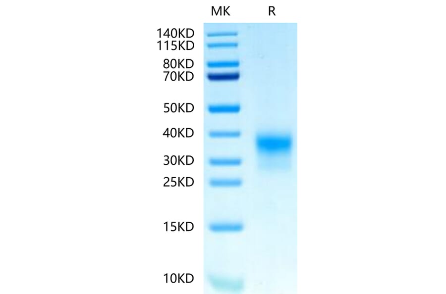Tris-Bis PAGE - Recombinant Human ErbB2 Protein (Biotin) (C-terminal His and Avi Tag) (A330589) - Antibodies.com