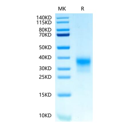 Tris-Bis PAGE - Recombinant Human ErbB2 Protein (Biotin) (C-terminal His and Avi Tag) (A330589) - Antibodies.com