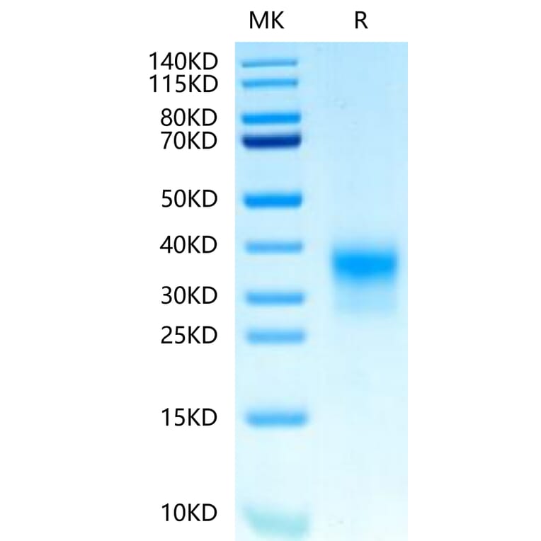 Tris-Bis PAGE - Recombinant Human ErbB2 Protein (Biotin) (C-terminal His and Avi Tag) (A330589) - Antibodies.com
