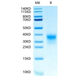Tris-Bis PAGE - Recombinant Human ErbB2 Protein (Biotin) (C-terminal His and Avi Tag) (A330589) - Antibodies.com
