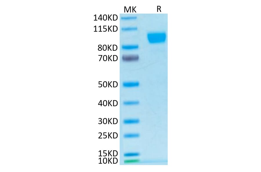 Tris-Bis PAGE - Recombinant Human ErbB2 Protein (Biotin) (C-terminal His and Avi Tag) (A330590) - Antibodies.com