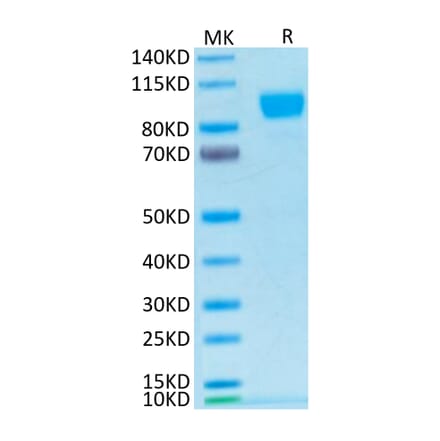 Tris-Bis PAGE - Recombinant Human ErbB2 Protein (Biotin) (C-terminal His and Avi Tag) (A330590) - Antibodies.com