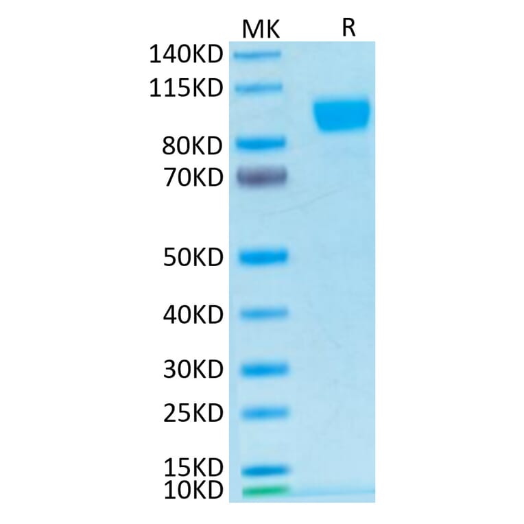 Tris-Bis PAGE - Recombinant Human ErbB2 Protein (Biotin) (C-terminal His and Avi Tag) (A330590) - Antibodies.com