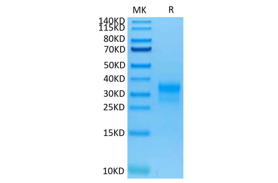 Tris-Bis PAGE - Recombinant Human ErbB2 Protein (C-terminal His and Avi Tag) (A330591) - Antibodies.com
