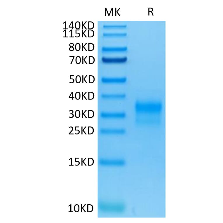 Tris-Bis PAGE - Recombinant Human ErbB2 Protein (C-terminal His and Avi Tag) (A330591) - Antibodies.com