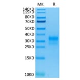 Tris-Bis PAGE - Recombinant Human ErbB2 Protein (C-terminal His and Avi Tag) (A330591) - Antibodies.com
