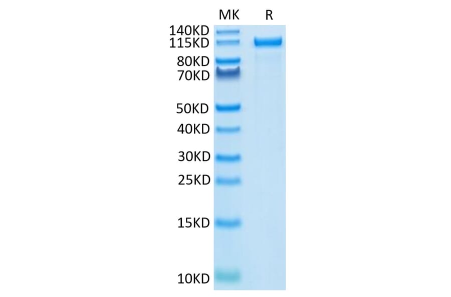 Tris-Bis PAGE - Recombinant Human ErbB2 Protein (C-terminal Human Fc Tag) (A330592) - Antibodies.com