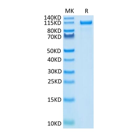 Tris-Bis PAGE - Recombinant Human ErbB2 Protein (C-terminal Human Fc Tag) (A330592) - Antibodies.com