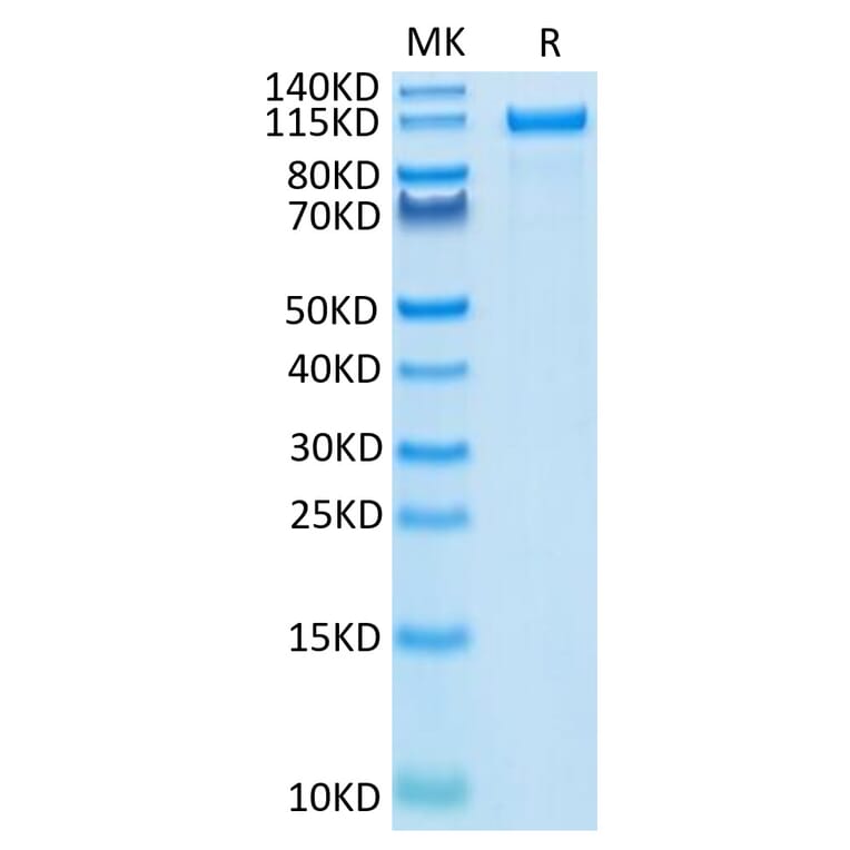 Tris-Bis PAGE - Recombinant Human ErbB2 Protein (C-terminal Human Fc Tag) (A330592) - Antibodies.com