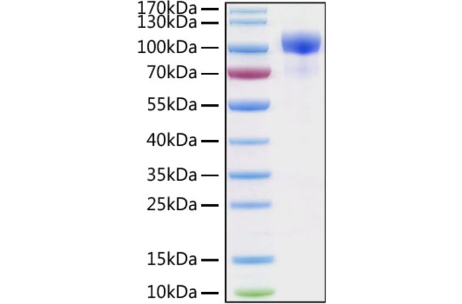 SDS-PAGE - Recombinant Human ErbB3/HER3 Protein (C-terminal His Tag) (A330593) - Antibodies.com