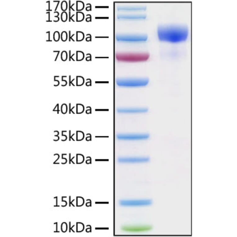 SDS-PAGE - Recombinant Human ErbB3/HER3 Protein (C-terminal His Tag) (A330593) - Antibodies.com