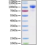 SDS-PAGE - Recombinant Human ErbB3/HER3 Protein (C-terminal His Tag) (A330593) - Antibodies.com