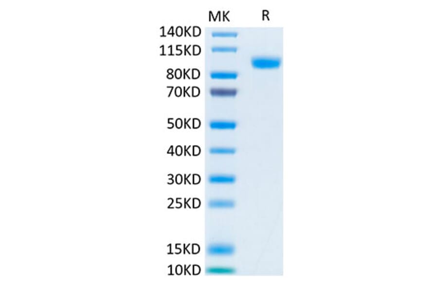 Tris-Bis PAGE - Recombinant Human ErbB3/HER3 Protein (Biotin) (C-terminal His and Avi Tag) (A330594) - Antibodies.com