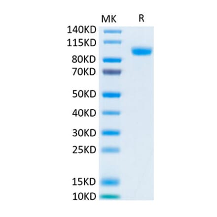 Tris-Bis PAGE - Recombinant Human ErbB3/HER3 Protein (Biotin) (C-terminal His and Avi Tag) (A330594) - Antibodies.com