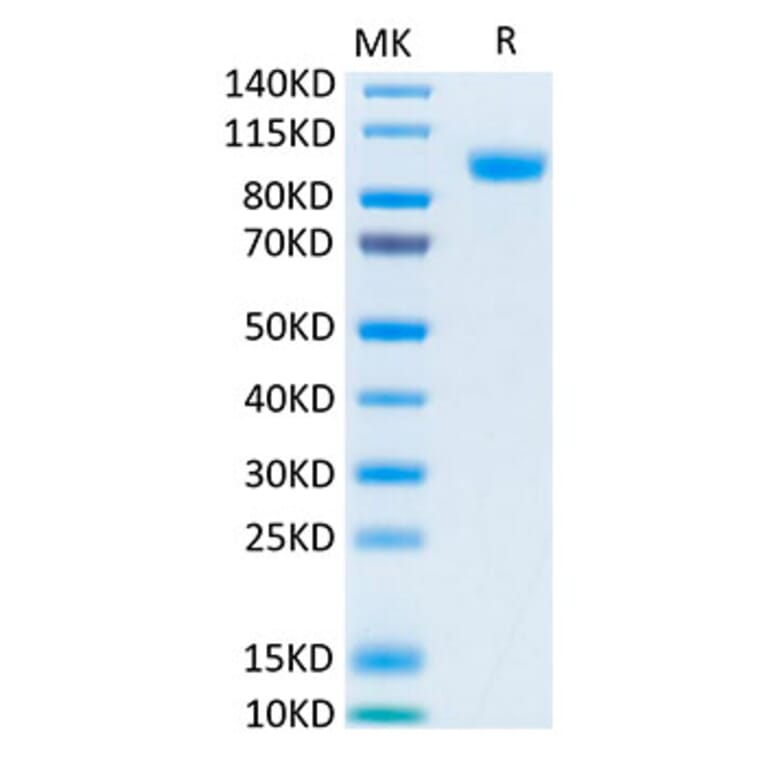 Tris-Bis PAGE - Recombinant Human ErbB3/HER3 Protein (Biotin) (C-terminal His and Avi Tag) (A330594) - Antibodies.com