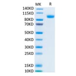 Tris-Bis PAGE - Recombinant Human ErbB3/HER3 Protein (Biotin) (C-terminal His and Avi Tag) (A330594) - Antibodies.com