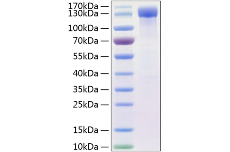 SDS-PAGE - Recombinant Human ErbB4 Protein (C-terminal Human Fc and His Tag) (A330595) - Antibodies.com