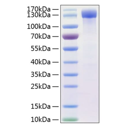 SDS-PAGE - Recombinant Human ErbB4 Protein (C-terminal Human Fc and His Tag) (A330595) - Antibodies.com