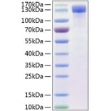 SDS-PAGE - Recombinant Human ErbB4 Protein (C-terminal Human Fc and His Tag) (A330595) - Antibodies.com