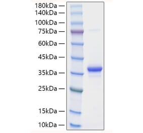 SDS-PAGE - Recombinant Mouse EREG Protein (N-terminal Human Fc Tag) (A330596) - Antibodies.com