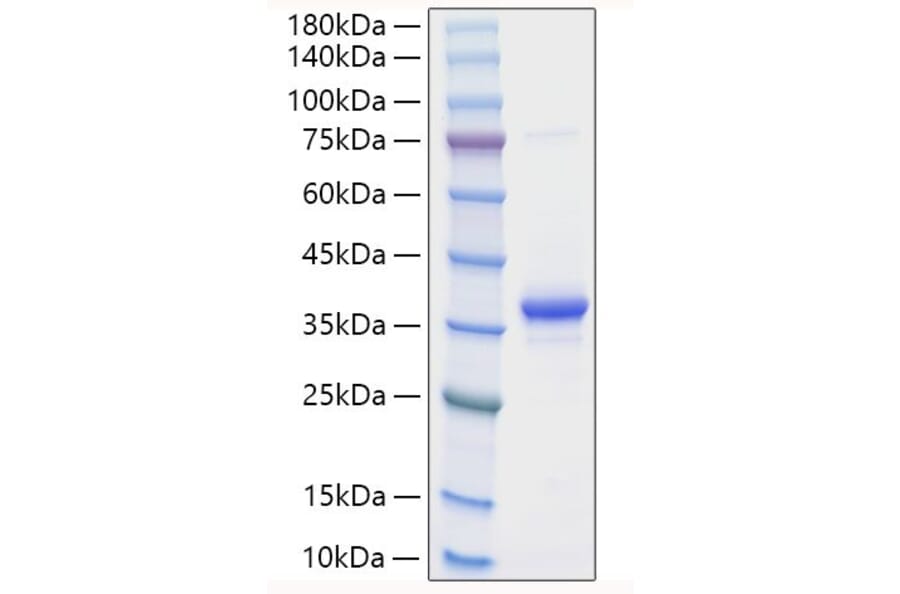 SDS-PAGE - Recombinant Mouse EREG Protein (N-terminal Human Fc Tag) (A330596) - Antibodies.com