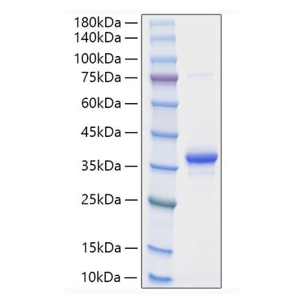 SDS-PAGE - Recombinant Mouse EREG Protein (N-terminal Human Fc Tag) (A330596) - Antibodies.com