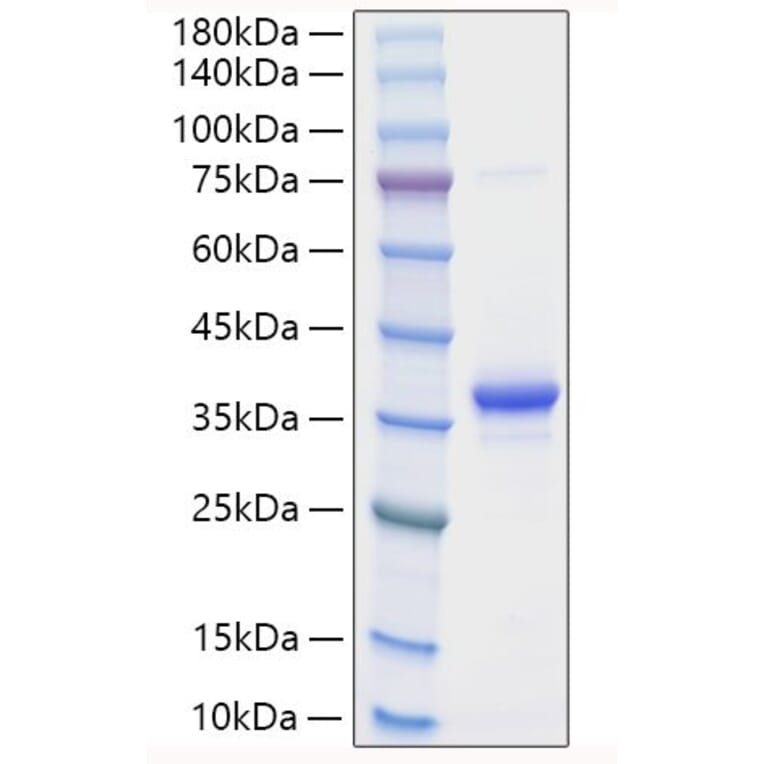 SDS-PAGE - Recombinant Mouse EREG Protein (N-terminal Human Fc Tag) (A330596) - Antibodies.com