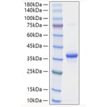 SDS-PAGE - Recombinant Mouse EREG Protein (N-terminal Human Fc Tag) (A330596) - Antibodies.com