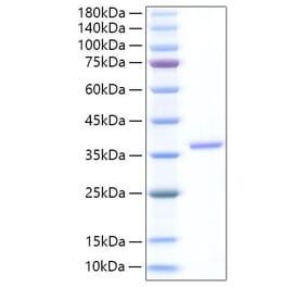 SDS-PAGE - Recombinant Human EREG Protein (N-terminal Human Fc Tag) (A330597) - Antibodies.com