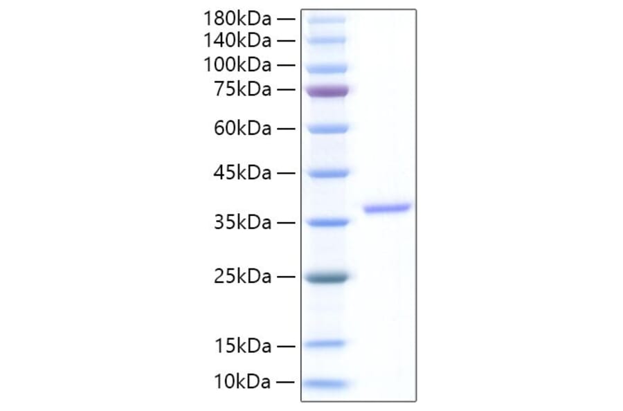 SDS-PAGE - Recombinant Human EREG Protein (N-terminal Human Fc Tag) (A330597) - Antibodies.com