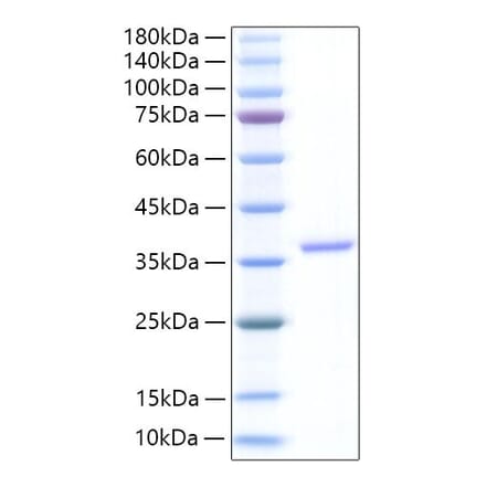 SDS-PAGE - Recombinant Human EREG Protein (N-terminal Human Fc Tag) (A330597) - Antibodies.com