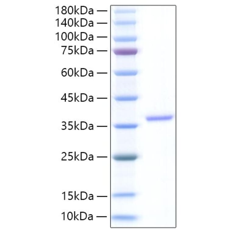 SDS-PAGE - Recombinant Human EREG Protein (N-terminal Human Fc Tag) (A330597) - Antibodies.com