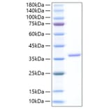 SDS-PAGE - Recombinant Human EREG Protein (N-terminal Human Fc Tag) (A330597) - Antibodies.com