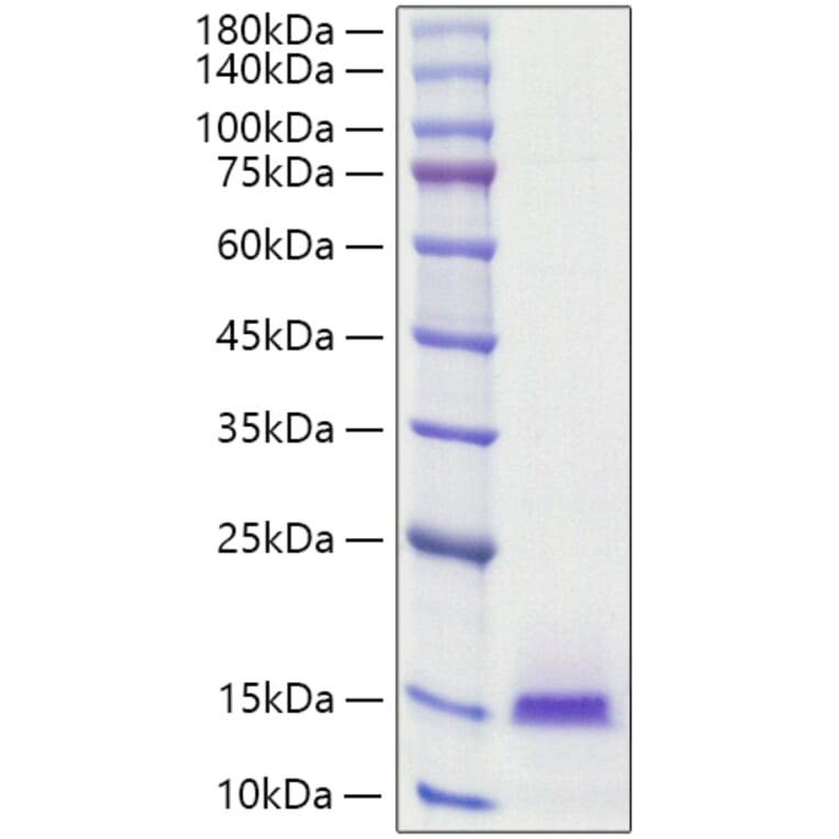 SDS-PAGE - Recombinant Human Estrogen Inducible Protein pS2 Protein (C-terminal His Tag) (A330599) - Antibodies.com