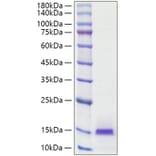 SDS-PAGE - Recombinant Human Estrogen Inducible Protein pS2 Protein (C-terminal His Tag) (A330599) - Antibodies.com