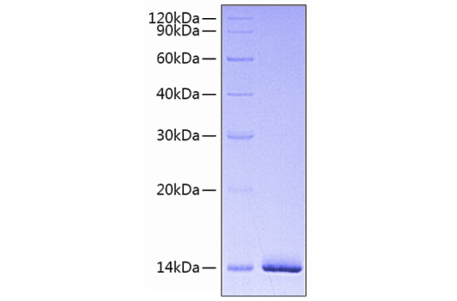 SDS-PAGE - Recombinant Human Estrogen Receptor alpha Protein (N-terminal His Tag) (A330600) - Antibodies.com