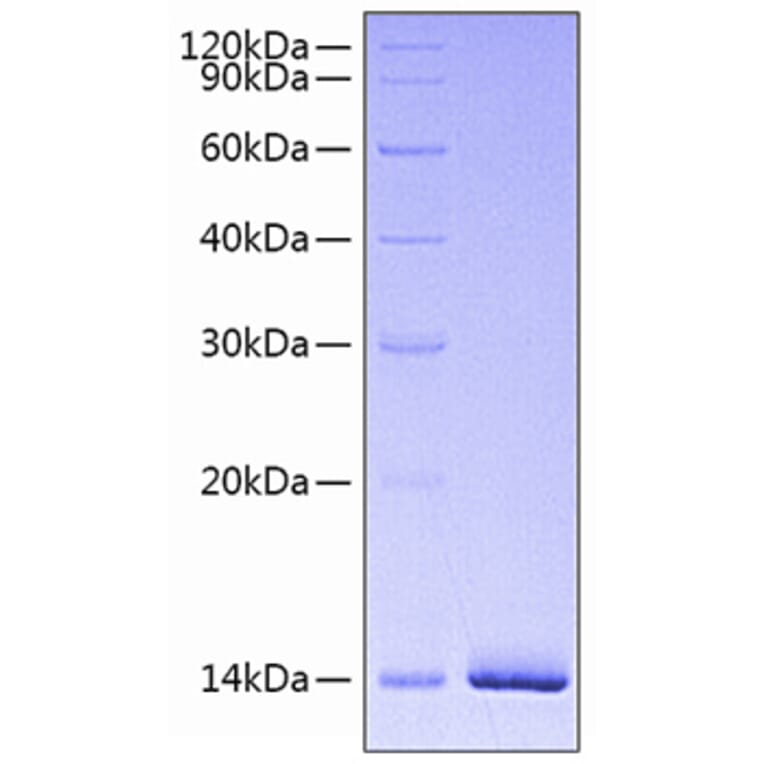 SDS-PAGE - Recombinant Human Estrogen Receptor alpha Protein (N-terminal His Tag) (A330600) - Antibodies.com