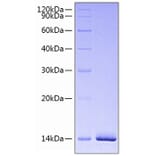 SDS-PAGE - Recombinant Human Estrogen Receptor alpha Protein (N-terminal His Tag) (A330600) - Antibodies.com