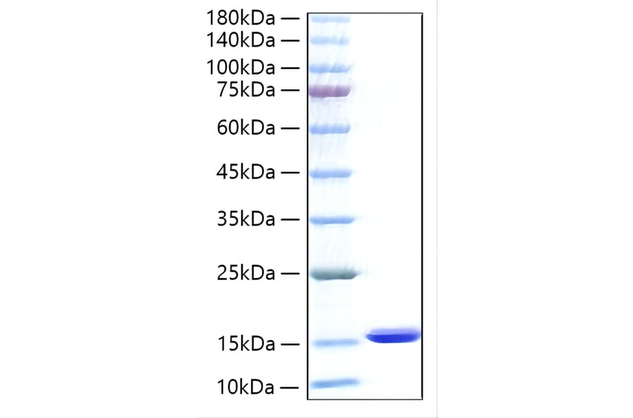 SDS-PAGE - Recombinant Human FABP1 Protein (N-terminal His Tag) (A330601) - Antibodies.com