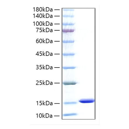 SDS-PAGE - Recombinant Human FABP1 Protein (N-terminal His Tag) (A330601) - Antibodies.com