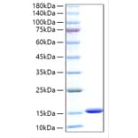 SDS-PAGE - Recombinant Human FABP1 Protein (N-terminal His Tag) (A330601) - Antibodies.com