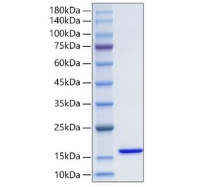 SDS-PAGE - Recombinant Human FABP3 Protein (N-terminal His Tag) (A330602) - Antibodies.com